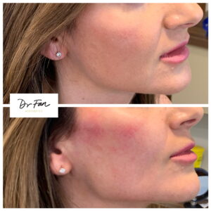 Benefits of Using Vigor Force Male Enhancement